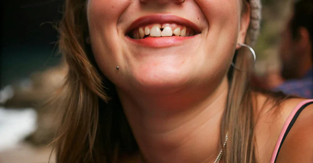 Smiley Piercing: Complete Guide to Upper Lip Frenulum Piercings