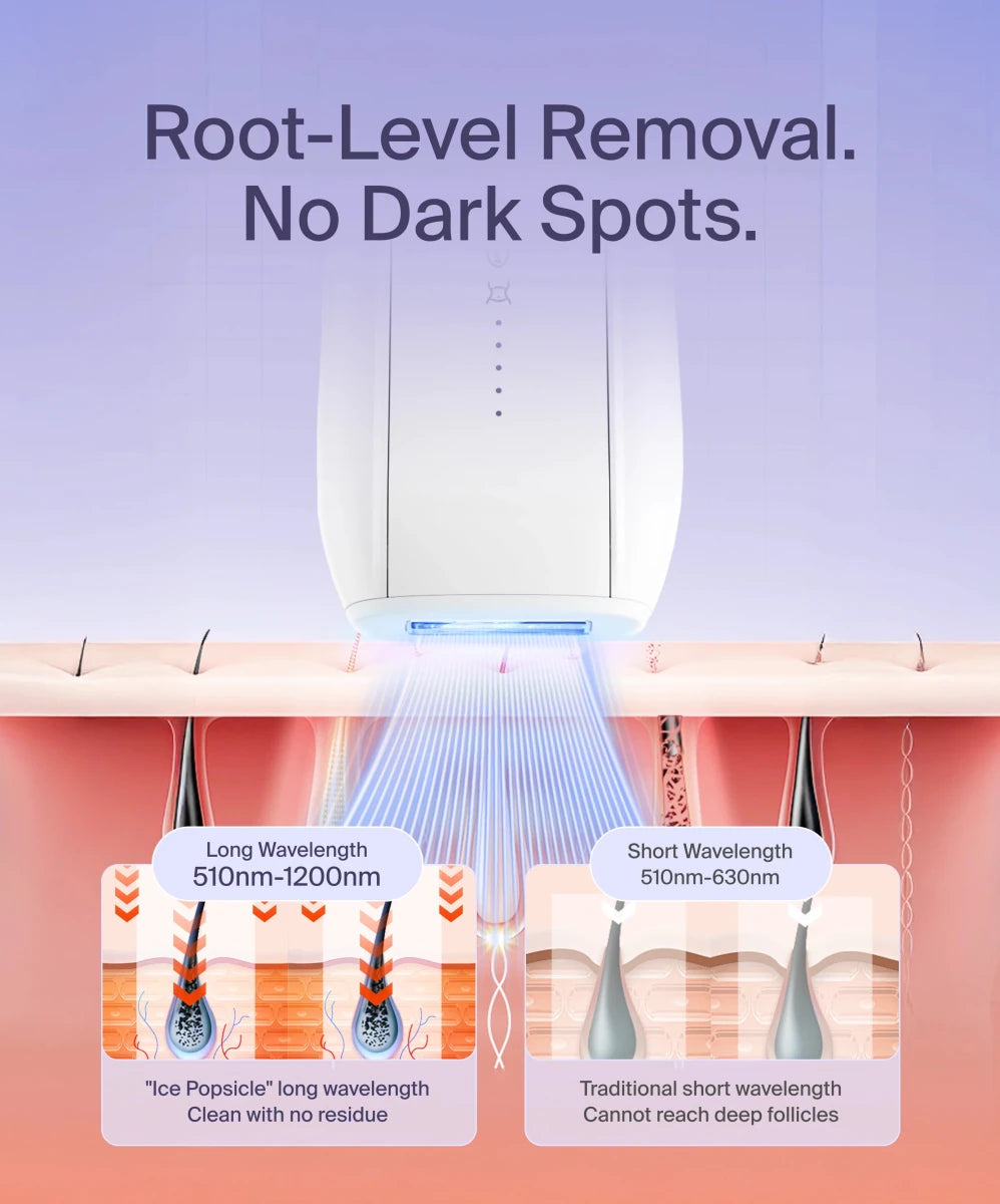 IPL Home Use Hair Removal Device - Jissbon