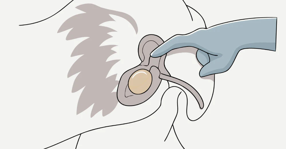 Where Is the P-Spot? Your Complete Guide